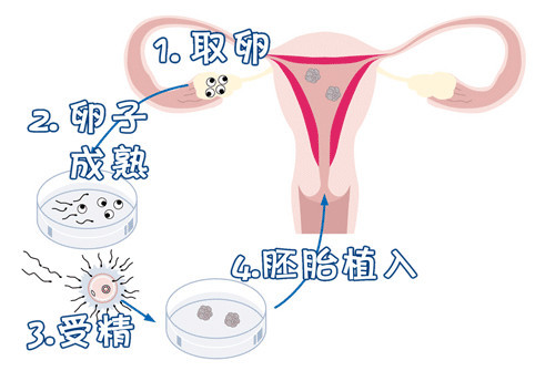 李雪梅