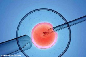 男性因素案例