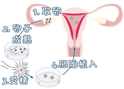王建国